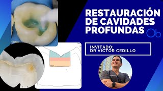 Restauración de Cavidades profundas 🦷 [upl. by Atirihs756]