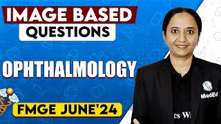 Ophthalmology  Image Based Questions  FMGE 2024  Dr Sudha [upl. by Jennine357]