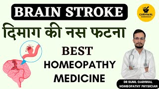 Brain Haemorrhage Homeopathic Medicine  Brain stroke Homeopathic Medicine  Brain Hemorrhage [upl. by Kauppi]