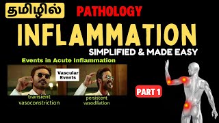 Acute Inflammation தரமான விளக்கம் தமிழில்  NF  KB  Vascular amp Cellular Events  General Pathology [upl. by Ripley684]