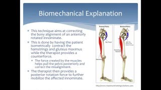 Mobilization to correct an Anterior Innominate rotation of the pelvis Physical Therapy [upl. by Gelb]