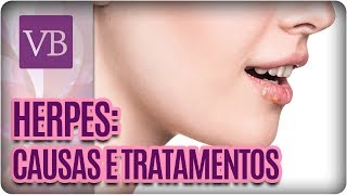 O que são herpes Entenda as Causas e Tratamentos  Você Bonita 110717 [upl. by Reena625]