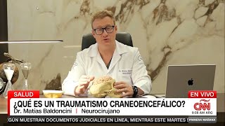 CNN Traumatismo Craneal Dr Baldoncini [upl. by Pasho]