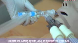 72 HR Double Swivel ElbowStop Valve Type Closed Suction Catheter [upl. by Anerev]