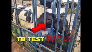 TB TEST FAIL [upl. by Juliano818]