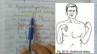 Parathyroid Disorders  Hypoparathyroidism and Hyperparathyroidism [upl. by Lyrrehs199]