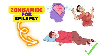 Zonisamide Review Understanding the Benefits and Potential Side Effects in Epilepsy Management [upl. by Hanikas685]