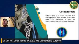 Dr Vinish Kumar Verma MBBS MS Orthopaedic Surgeon [upl. by Llertak]