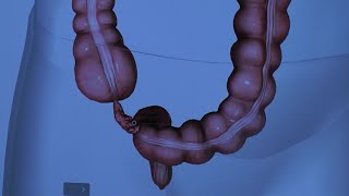 The Anatomy of the Appendix [upl. by Amena]