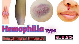 Hemophilia  Hemophilia types  Hemophilia A  Hemophilia B Hemophilia C Doctors goal [upl. by Stila266]