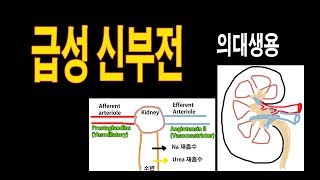 급성신부전Prerenal AKI 의사의대생용 [upl. by Papp]