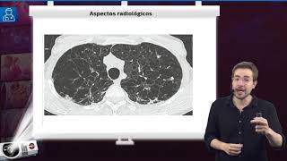 Doença Pulmonar Obstrutiva Crônica DPOC  Aula de Pneumologia SanarFlix [upl. by Awjan]