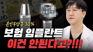 💰65세 건강보험 임플란트 vs 일반 임플란트  어버트먼트와 크라운 비교까지👀 [upl. by Cogen]