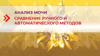 Анализ мочи  сравнение результатов ручного и автоматического методов [upl. by Siravrat857]