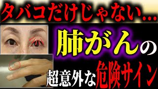 【肺がん】絶対に見逃さないで！タバコだけじゃない！意外すぎる肺がんの症状とは？【予防医学】【医学】【健康】【医療】【本の要約】【がん】 [upl. by Archle165]