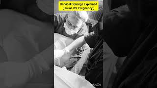 Cervical Cerclage Procedure for twin IVF pregnancy by Dr Rakshita Malik ivf pregnancy twins [upl. by Barlow]