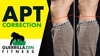 Anterior Pelvic Tilt Before and After [upl. by Nimesh]