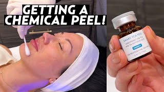 I Got a Chemical Peel My Experience With SkinCeuticals TCA Peel for Hyperpigmentation amp Melasma [upl. by Cony]