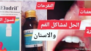 طريقة استعمالEludril من الصيدلية لعلاج تعفنات اللثة وعلاج التهاب اللثة [upl. by Axe]