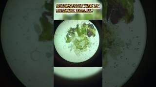 microscopic view of rhizoid scales scales slide botany botanicalart thanksforwatching [upl. by Nosyla]