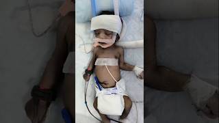 Nicu cute baby ❣️ shorts short ytshort trending viralshort viralvideo DrnitishSingh [upl. by Aelc]