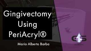 Gingivectomy Using PeriAcryl®  Mario Alberto Barba [upl. by Juback]