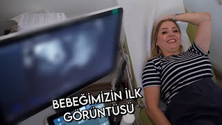 BEBEĞİMİZİN İLK KONTROLÜ  BEBEĞİMİZİ GÖRDÜK [upl. by Eimme]