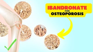 Ibandronate Sodium Supporting Bone Health and Osteoporosis Prevention [upl. by Nosirb]