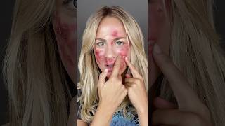 MRSA viralvideo creepy makeup makeuptransformation scary [upl. by Chyou]