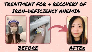 Iron Deficiency Anemia Treatment My Recovery Story [upl. by Chapnick]