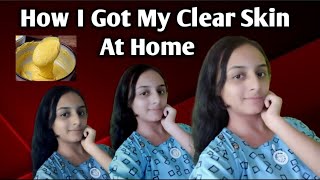 How I Got Clear Skin At Home✨  Secret Of My Clear Skin ✨  Beautytipsbylakhi  How To Get Glas Skin [upl. by Liban711]