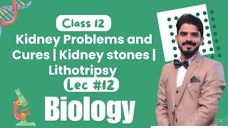 Kidney Problems and Cures  Kidney stones  Lithotripsy  Homeostasis  Biology Class 12  lec12 [upl. by Pudendas254]