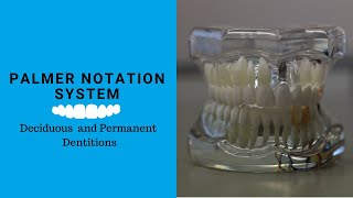 Palmer tooth Notation System  Tooth notation system [upl. by Kalam]