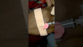 Intravenous cannula method  IV Cannulation technique porcedure amp Practical [upl. by Adigirb]