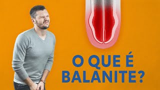 O que é balanite [upl. by Hamilton111]