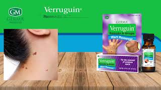 Germa Verruguin  Wart Remover [upl. by Eudosia]