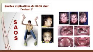 Webinaire SAOS de l’enfant Particularités et Prise en charge [upl. by Ettesoj]