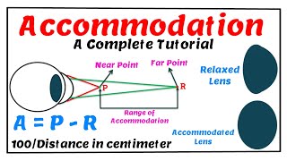 Accommodation A Complete Tutorial [upl. by Kern]