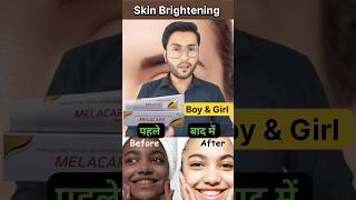 चहेरे को गोरा बनाए 😱 Skin Brightening Cream 💯 shorts [upl. by Sommer982]