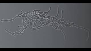 Multiple fission in Corynebacterium matruchotii [upl. by Enyalb]