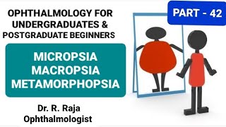 42  MICROPSIA MACROPSIA METAMORPHOPSIA  by Dr R Raja See Description [upl. by Durst]