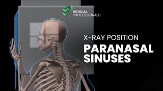 Radiographic Positioning PARANASAL SINUSES [upl. by Naerda]