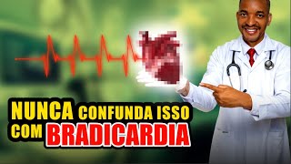 O QUE NAO É BRADICARDIA [upl. by Ayoted]