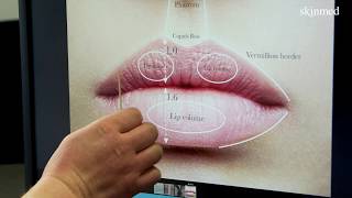 Die optimale Lippenform [upl. by Amora]