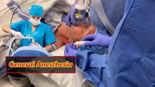 Patient under General Anesthesia bsanesthesianursing [upl. by Namrac]