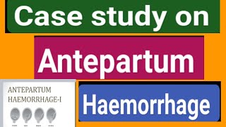 Case study on Antepartum haemorrhage videosyoutubevideosviral [upl. by Navap]