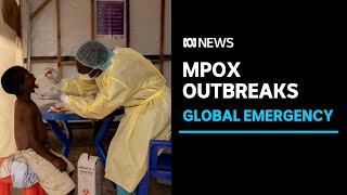 Monkeypox declared a global public health emergency World Health Organization  ABC News [upl. by Saenihp]