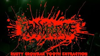 CxBxFxIxHxFxLxFxRxE  Rusty Crowbar Tooth Extraction OFFICIAL VIDEO [upl. by Kazim]