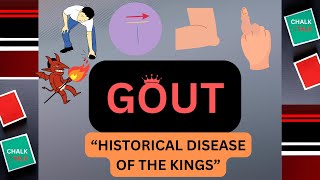 GOUT UNDERSTANDING THE DISORDER [upl. by Animsay685]