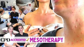 Introduction To Our New Mesotherapy Course  Everything You Need To Know Microneedling Skin Care [upl. by Ahsiemak]